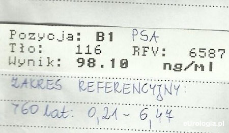 PSA 100 ng - negatywna biopsja