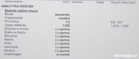 Mocz - badanie ogólne