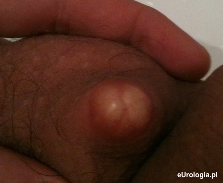 Biała kulkana sk&oacute;rze moszny