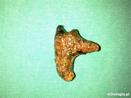 Zł&oacute;g odlewowy