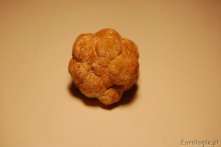 Kamica pęcherza moczowego