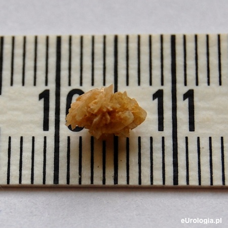 Zł&oacute;g wapniowo - fosforanowy