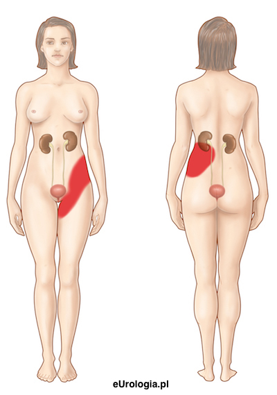 Lokalizacja b&oacute;lu w kolce nerkowej