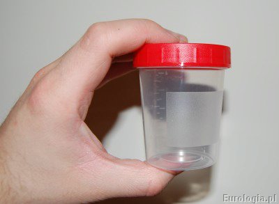 Pojemnik na mocz - niejałowy