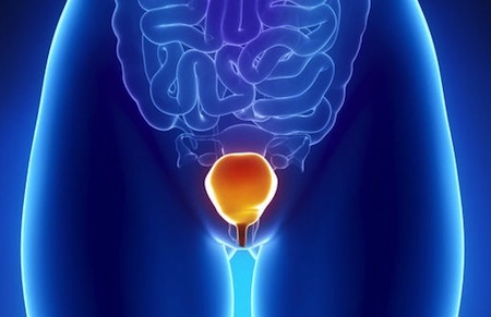 Profilaktyka zakażeń układu moczowego