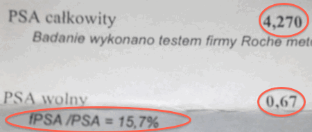 PSA wolne/całkowite.