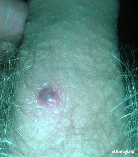 Wrz&oacute;d na prąciu