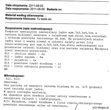 Wynik histopatologiczny z orchiektomii - Seminoma testis.
